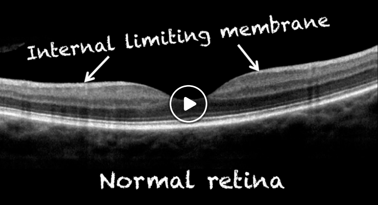 Episode 53: Don’t Let this Membrane Fool You